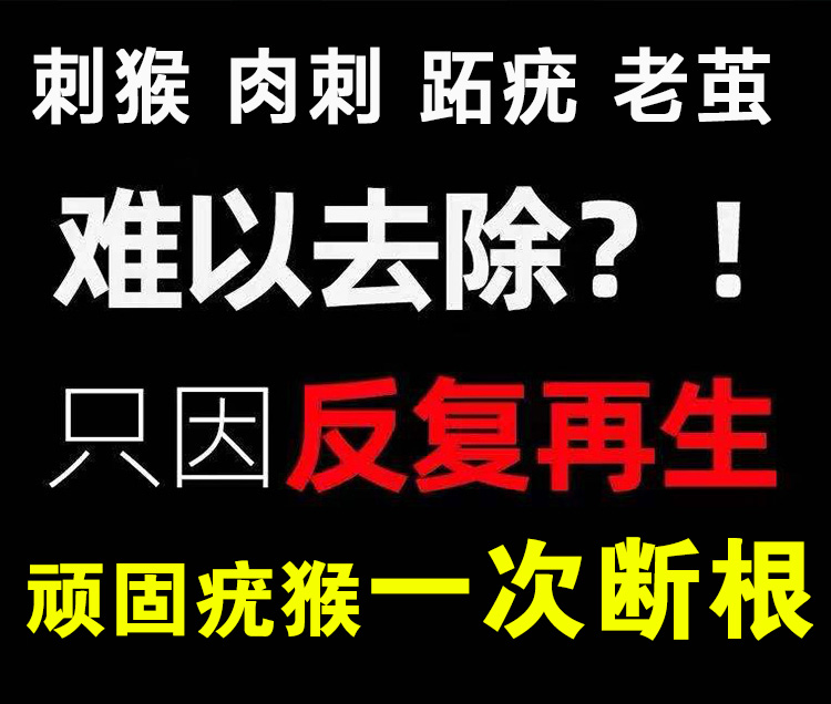O1CN01c1RMaF1I9nm98ilF1_!!2854160851.jpg